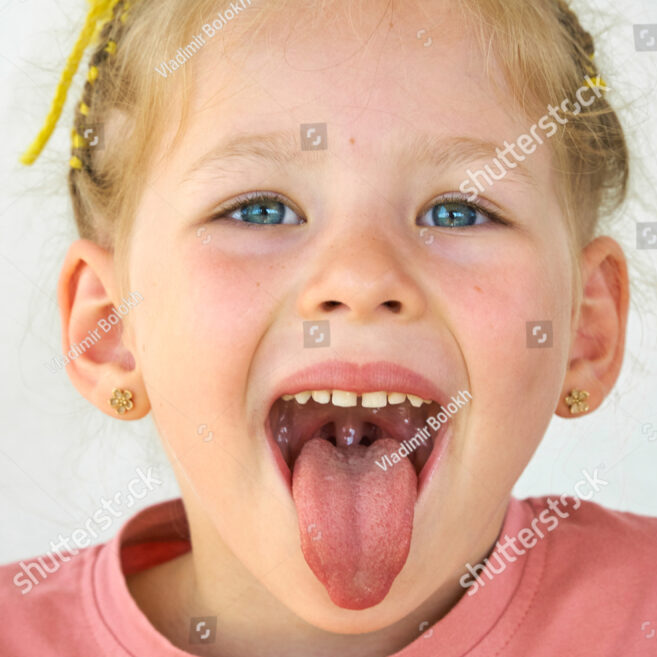 Milchzähne vom Feinsten